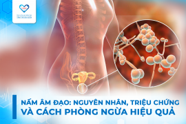NẤM ÂM ĐẠO: NGUYÊN NHÂN, TRIỆU CHỨNG VÀ CÁCH PHÒNG NGỪA HIỆU QUẢ