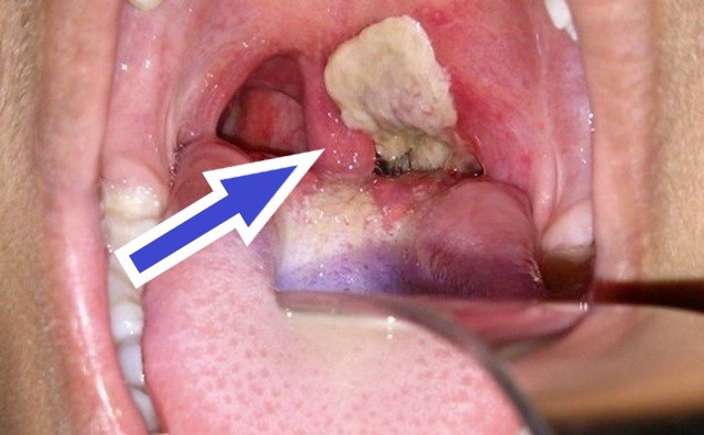 benhbachhau-1572967792342-1593103228734