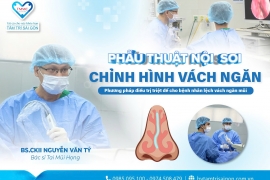​​PHẪU THUẬT NỘI SOI CHỈNH HÌNH VÁCH NGĂN MŨI – GIẢI PHÁP CHO NGƯỜI BỆNH LỆCH VÁCH NGĂN
