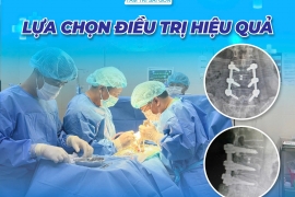 PHẪU THUẬT CỘT SỐNG – HÀNH TRÌNH HỒI PHỤC CỦA BỆNH NHÂN ĐAU LÂU NĂM