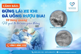 CẢNH BÁO: ĐỪNG LÁI XE KHI ĐÃ UỐNG RƯỢU BIA!