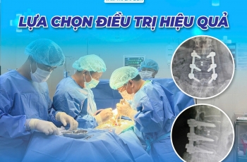 PHẪU THUẬT CỘT SỐNG – HÀNH TRÌNH HỒI PHỤC CỦA BỆNH NHÂN ĐAU LÂU NĂM