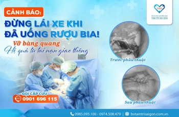 CẢNH BÁO: ĐỪNG LÁI XE KHI ĐÃ UỐNG RƯỢU BIA!