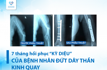 HÀNH TRÌNH 7 THÁNG HỒI PHỤC “KÌ DIỆU” CỦA BỆNH NHÂN ĐỨT DÂY THẦN KINH QUAY