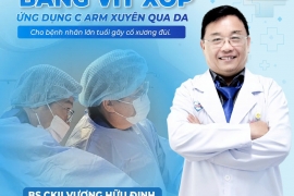 KẾT HỢP XƯƠNG BẰNG VÍT XỐP – ỨNG DỤNG C-ARM XUYÊN QUA DA CHO BỆNH NHÂN CAO TUỔI CÓ NHIỀU BỆNH NỀN