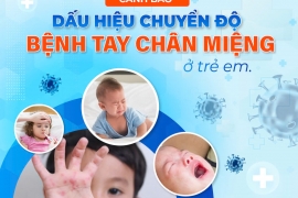 CẢNH BÁO DẤU HIỆU CHUYỂN ĐỘ BỆNH TAY CHÂN MIỆNG Ở TRẺ EM 