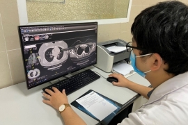 CÁC VIỆC NÊN LÀM ĐỂ TRÁNH TÍNH TRẠNG "SƯƠNG MÙ NÃO"