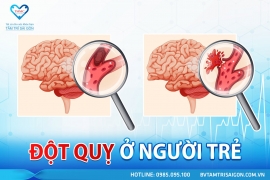 ĐỘT QUỴ NÃO Ở NGƯỜI TRẺ TUỔI