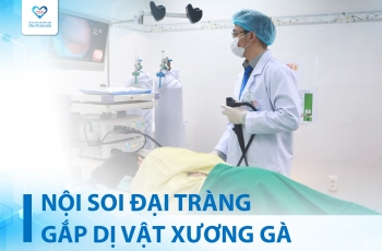 NỘI SOI ĐẠI TRÀNG GẮP XƯƠNG GÀ CHO NGƯỜI PHỤ NỮ 62 TUỔI