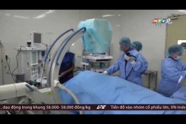 Nội Soi ERCP