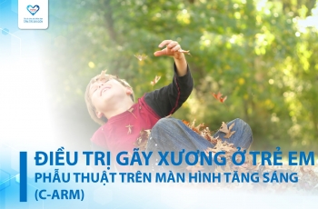 ĐIỀU TRỊ GÃY XƯƠNG Ở TRẺ EM BẰNG PHƯƠNG PHÁP PHẪU THUẬT XUYÊN ĐINH KÍN TRÊN MÀN HÌNH TĂNG SÁNG C-ARM