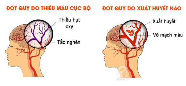 YYT_QUY_1