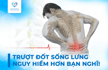 TRƯỢT ĐỐT SỐNG LƯNG – NGUY HIỂM HƠN BẠN NGHĨ!