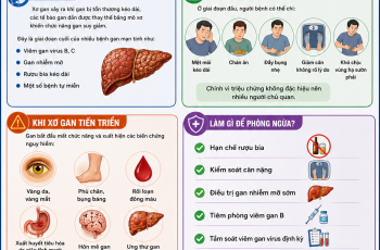 XƠ GAN KHÔNG PHẢI LÚC NÀO CŨNG CÓ TRIỆU CHỨNG RÕ RÀNG