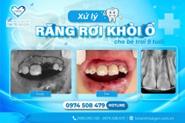 XỬ LÝ RĂNG RƠI KHỎI Ổ CHO BÉ TRAI 9 TUỔI 