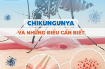 ​​CHIKUNGUNYA: TRIỆU CHỨNG, CÁCH PHÒNG NGỪA VÀ ĐIỀU TRỊ 