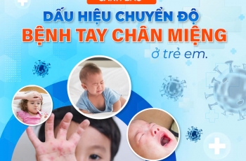 CẢNH BÁO DẤU HIỆU CHUYỂN ĐỘ BỆNH TAY CHÂN MIỆNG Ở TRẺ EM 