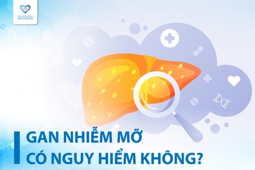 BỆNH GAN NHIỄM MỠ CÓ NGUY HIỂM KHÔNG? CÓ THỂ ĐIỀU TRỊ TẠI NHÀ KHÔNG