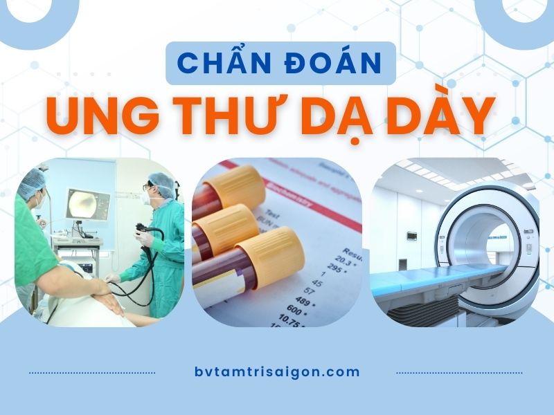 Các phương pháp chẩn đoán ung thư dạ dày