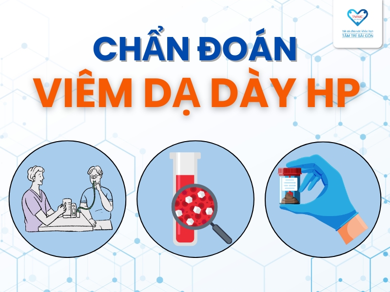 Chẩn đoán vi khuẩn HP dạ dày