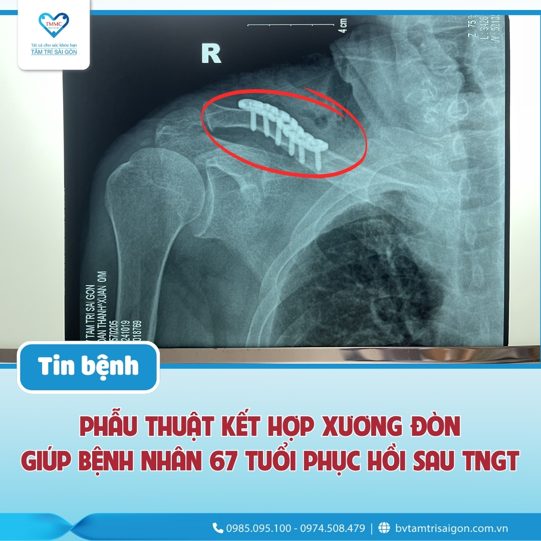 Kết quả sau phẫu thuật