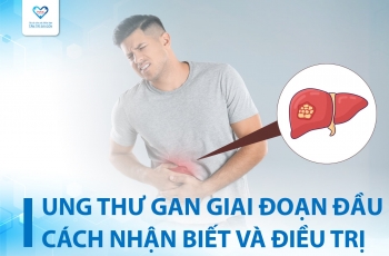 UNG THƯ GAN GIAI ĐOẠN ĐẦU: CÁCH NHẬN BIẾT VÀ ĐIỀU TRỊ