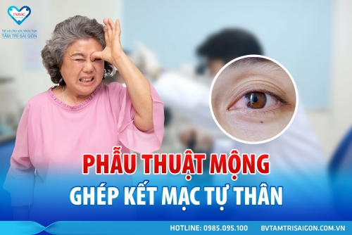 PHẪU THUẬT MỘNG GHÉP KẾT MẠC TỰ THÂN