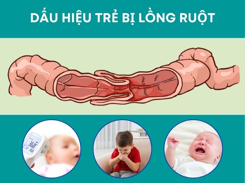 Dấu hiệu nhận biết trẻ bị lồng ruột