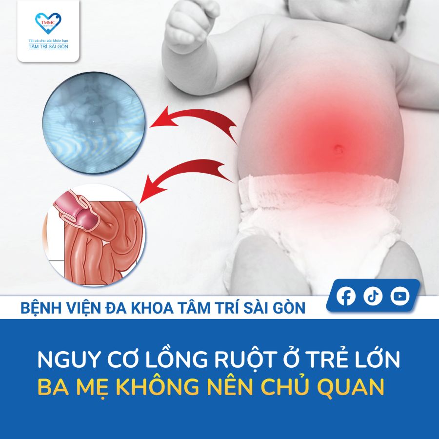 Tháo lồng ruột bằng hơi