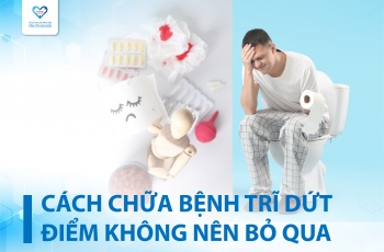 CÁCH CHỮA BỆNH TRĨ DỨT ĐIỂM KHÔNG NÊN BỎ QUA