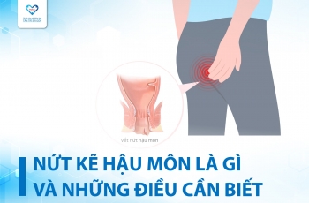 NỨT KẼ HẬU MÔN: NGUYÊN NHÂN, TRIỆU CHỨNG, CÁCH ĐIỀU TRỊ VÀ PHÒNG NGỪA