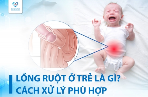 LỒNG RUỘT Ở TRẺ EM LÀ GÌ? CÁCH XỬ LÝ KHI TRẺ BỊ LỒNG RUỘT