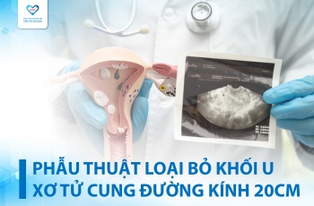 LOẠI BỎ KHỐI U XƠ TỬ CUNG 20CM - CHẤM DỨT TÌNH TRẠNG RONG KINH, THIẾU MÁU NẶNG CHO NỮ BỆNH NHÂN 43 TUỔI