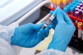 Chuyên Khoa Xét Nghiệm